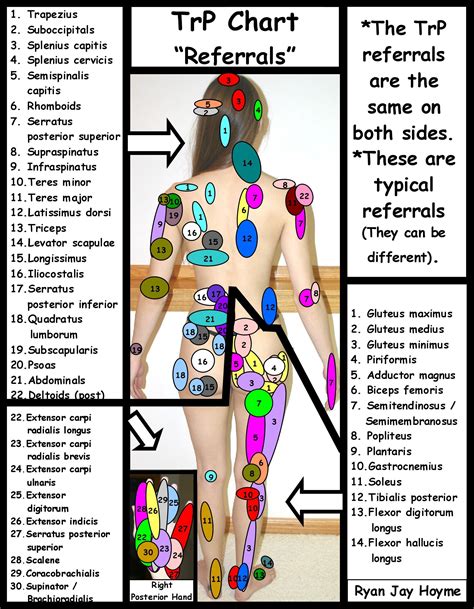 Trigger Point pain referral chart. A trigger point is a section of your ...