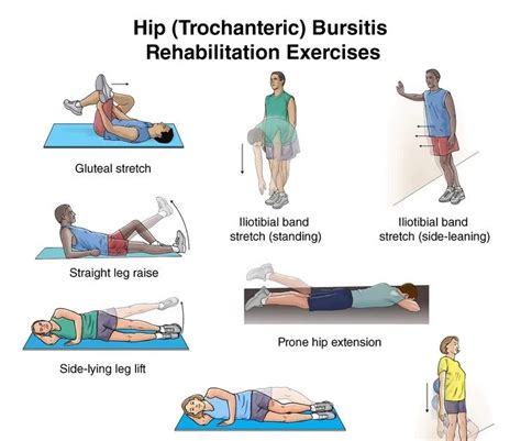 Trochanteric bursitis : causes, symptoms, diagnosis & treatment