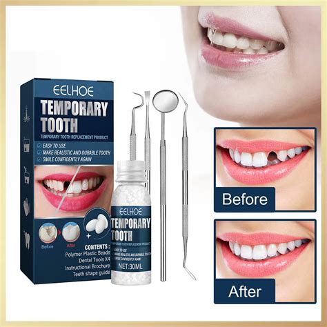 Temporary Tooth Filling Repair Kit False Teeth Solid Glue Dental Repair ...