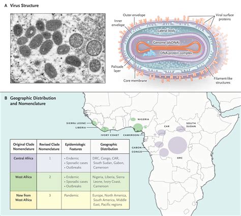 Monkeypox | NEJM