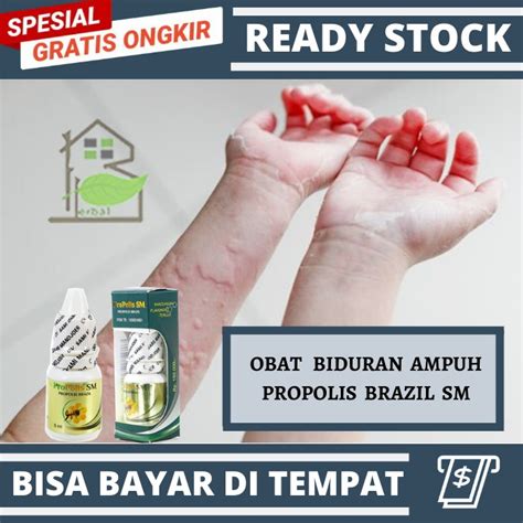 Obat Alergi Dingin Dan Debu - Homecare24