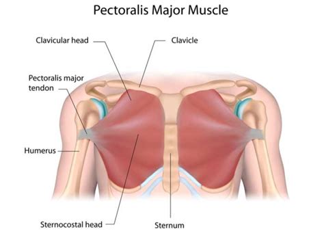 Pectoralis Major Tendon Tear | Orthopedic Shoulder Doctor | Manhattan ...