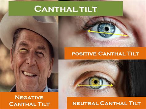 Canthal Tilt |Positive and Negative Tilt Ultimate Guide 2020