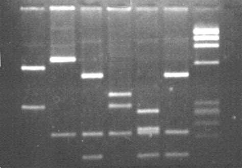 DNA Electrophoresis