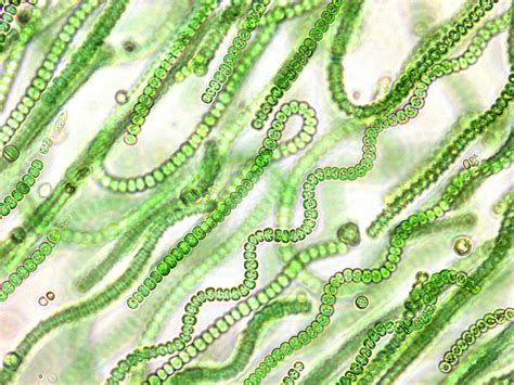 Cyanobacteria Under Microscope