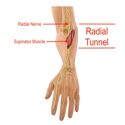 Radial Nerve Wrist