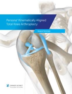 Persona | The Personalized Knee by Zimmer Biomet