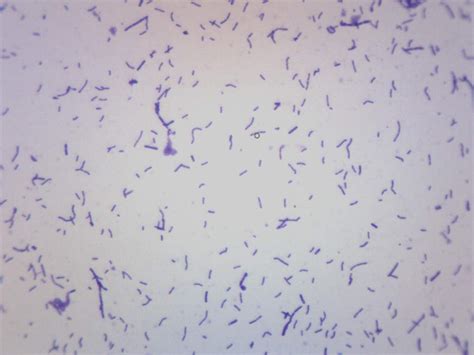 Lactobacillus Bulgaricus Microscope