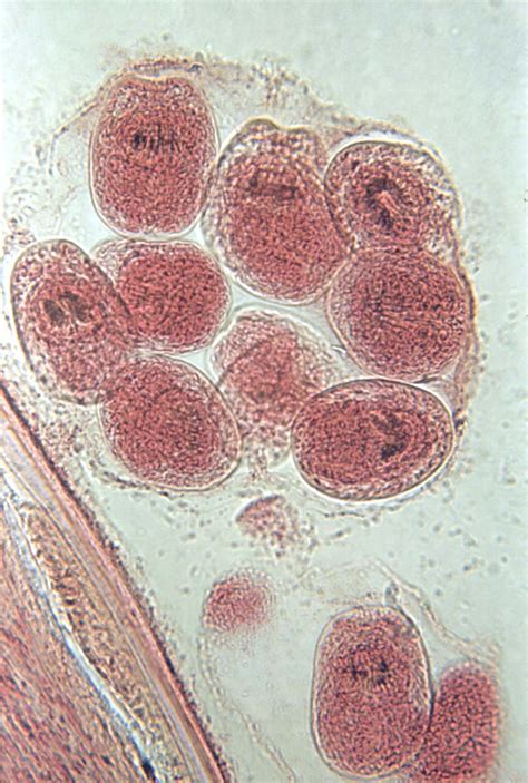 Echinococcus. Causes, symptoms, treatment Echinococcus