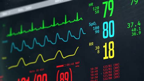 ICU Monitor Showing Patient's Condition, High Temperature, Arrhythmia ...