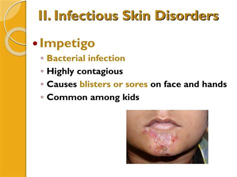 PPT - Integumentary System Part 2: Skin Disorders PowerPoint ...