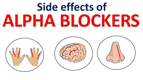 Alpha blocker side effects in easy way - Prazosin, Terazosin ...