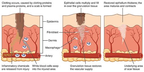 The Four-Stage Process of Wound Healing | Shop Wound Care