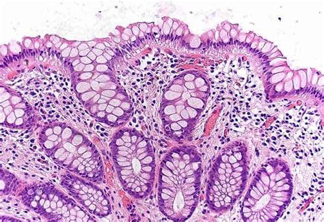 Trachea Histology Goblet Cells