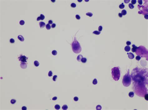 File:Giardia lamblia cytology.jpg - Wikimedia Commons