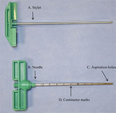 Bone Marrow Biopsy - Reasons, Pain, Complications