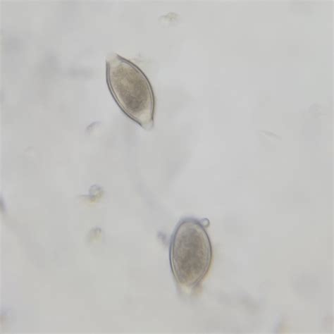 Trichuris trichiura ova whole mount, natural color, prepared microscope ...