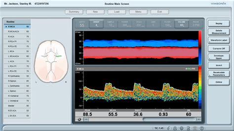 5 Reasons to use Transcranial Doppler Instead of an MRI - MedTech Edge