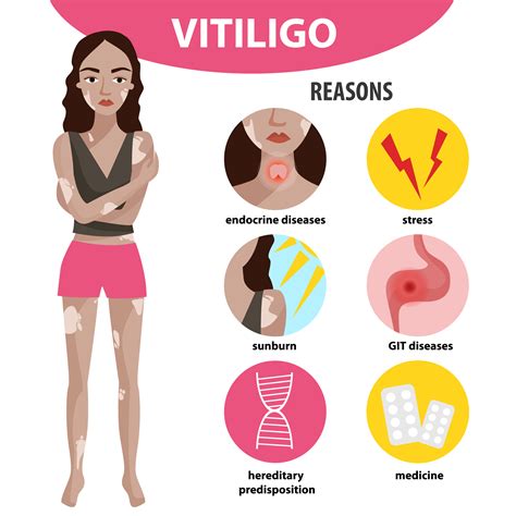 What is Vitiligo? | Skin We Are In