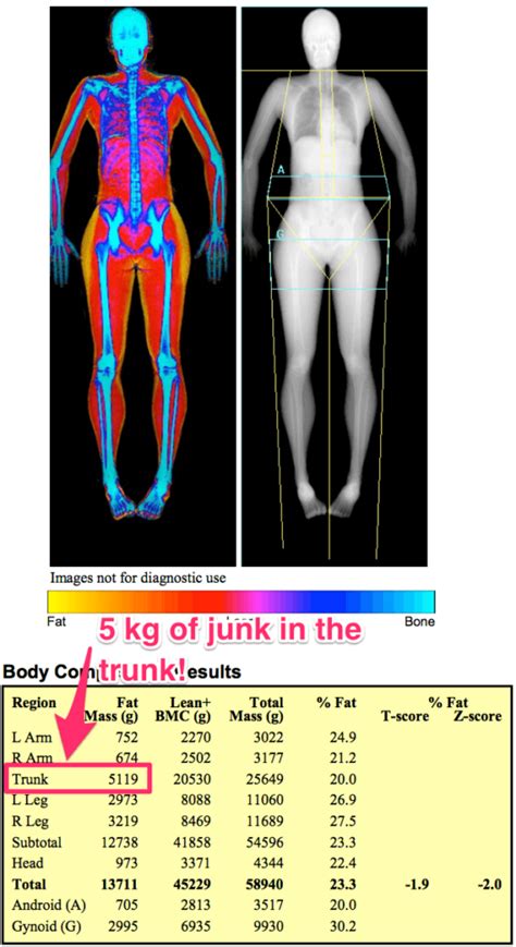 Want to Get Fit? How a DEXA Scan Can Help You Achieve Your Goals