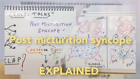 Post - Micturition Syncope Pathophysiology - Crosstalk - YouTube