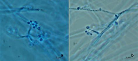 Phase-contrast microscopy of Beauveria bassiana HC-Z1 (a) and HC-Z2 (b ...