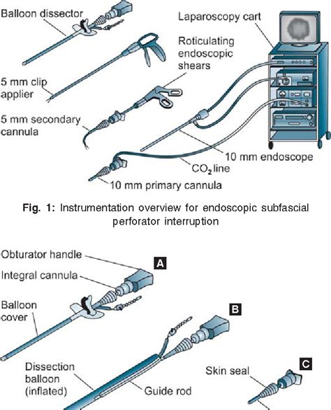 Subfascial Endoscopic Perforator Surgery in Perforator Vein ...