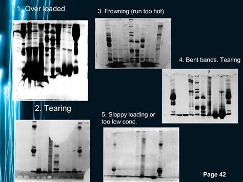 Polyacrylamide gel electrophoresis