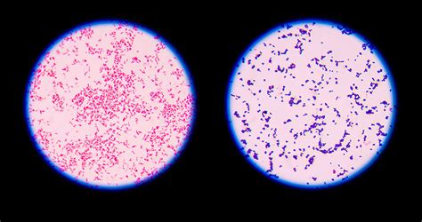 E Coli Gram Stain