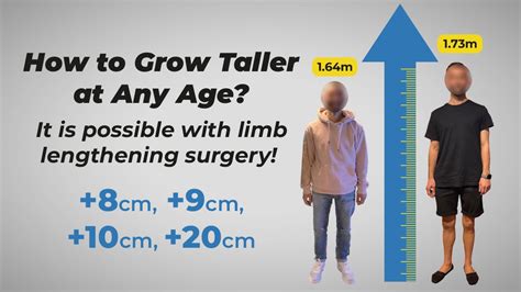 how to grow taller at 16 male - Howgrowpro