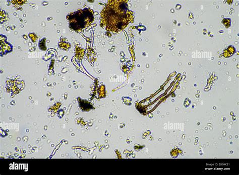 soil sample under the microscope. soil fungi and microorganisms cycling ...