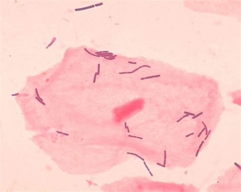 Lactobacillus - Alchetron, The Free Social Encyclopedia