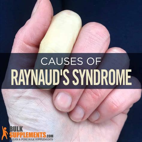 Raynaud's Syndrome: Symptoms, Causes & Treatment