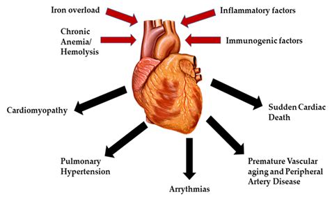 Thalassemia Reports | Free Full-Text | Cardiovascular Complications in ...