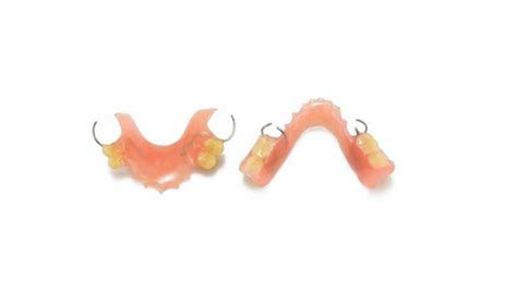 Flipper Tooth (Temporary Partial Denture) All You Need to Know