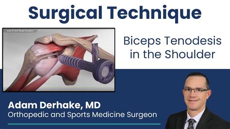 Biceps Tenodesis in the Shoulder: Surgical Technique - YouTube