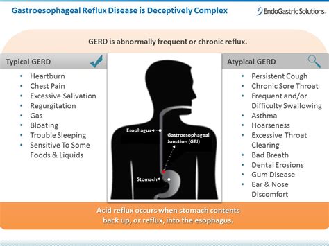 If You Have Acid Reflux, Do Not Eat Or Drink These 20 Things Slideshow ...