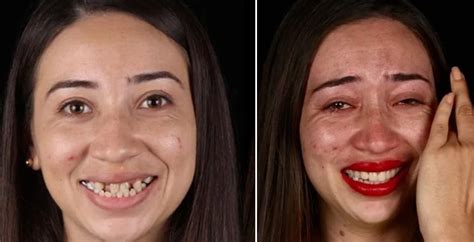 Dentist gives free dental makeovers and shares the incredible before ...