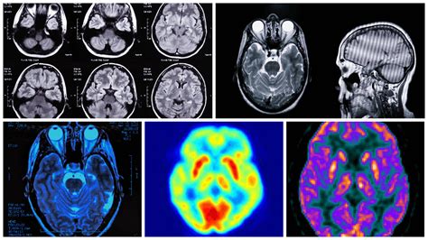 What is Radiology and What is it used for? - Yukigassen Canada