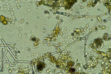 soil microbes organisms in a soil and compost sample, fungus and fungi ...