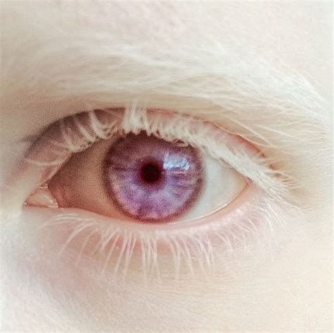 35 best Violet Eyes images on Pinterest | Eyes, Albinism and Violet eyes