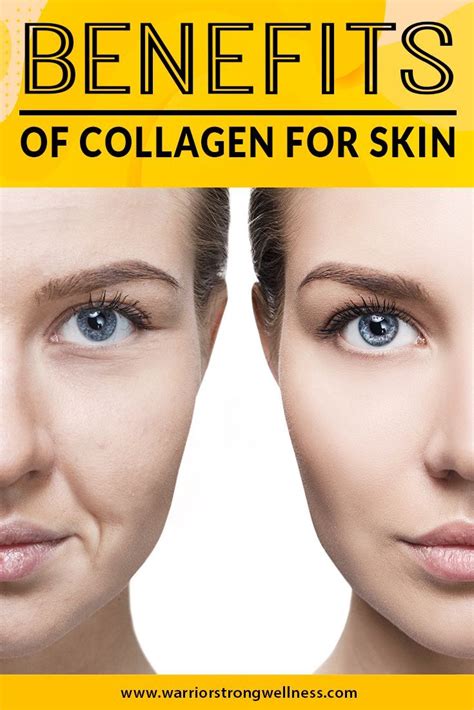 Benefits of Collagen for Skin | Collagen benefits, Collagen, Skin