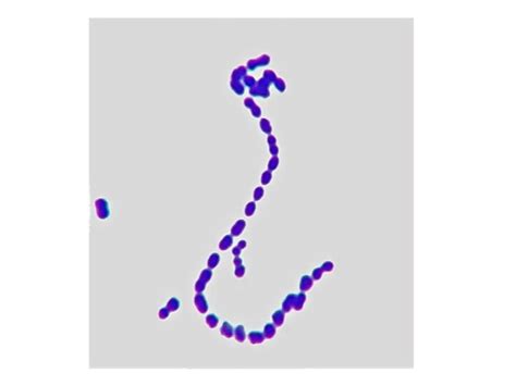 Streptococcus pyogenes Gram Stain | Microbiology, Stain techniques, Fungi