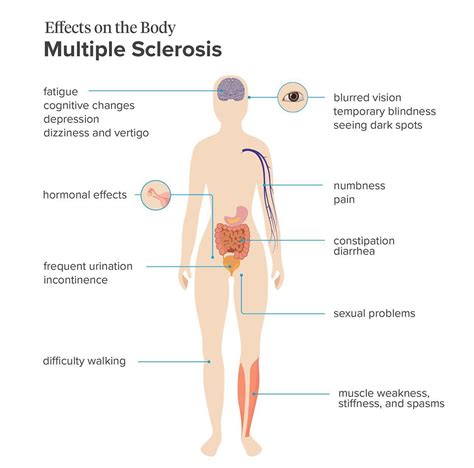 effects-on-the-body-ms-br-image-credit-stephen-kelly-2019-br copy ...