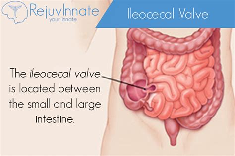 Ileocecal Valve - RejuvInnate