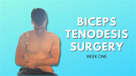 Biceps Tenodesis Surgery Recovery - Week One - YouTube