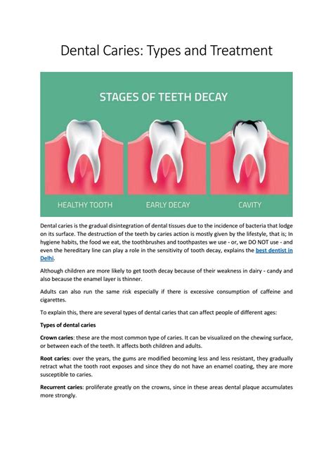 Dental Caries: Types and Treatment by Gaurav Dinesh Jain - Issuu