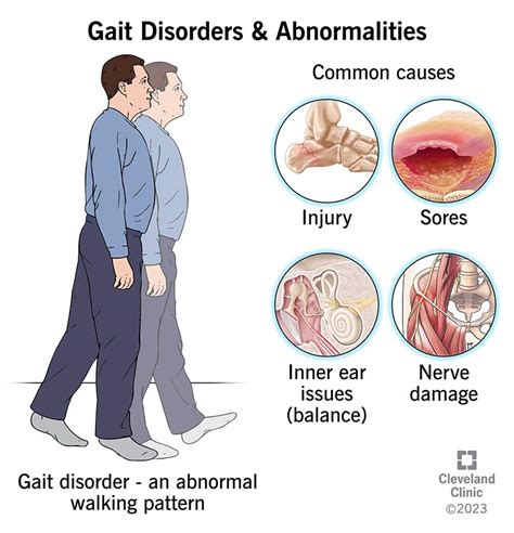 Gait Disorders and Abnormalities – A2Z Facts