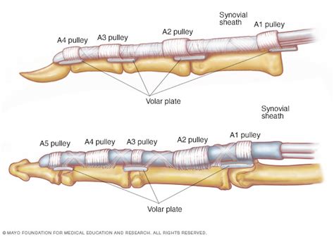 Flexor Tendon Research - Orthopedic Biomechanics Research - Mayo Clinic ...