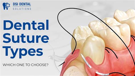 Dental Suture Types - which one to choose? - YouTube